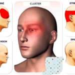 05 Types of Headaches: Causes, Symptoms, and Treatment.